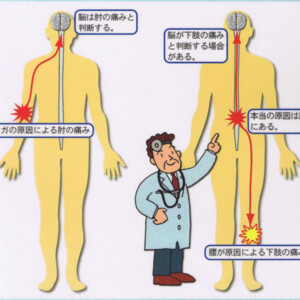 原因不明の慢性的な疾患はなぜ起こる？